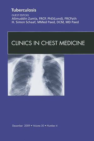 Tuberculosis, An Issue of Clinics in Chest Medicine (Volume 30-4) (The Clinics: Internal Medicine, Volume 30-4)