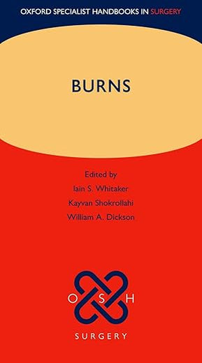 Burns (Oxford Specialist Handbooks in Surgery)