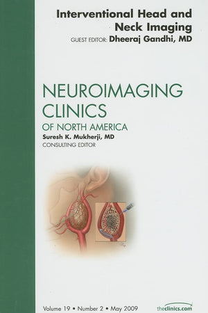 Interventional Head and Neck Imaging, An Issue of Neuroimaging Clinics (Volume 19-2) (The Clinics: Radiology, Volume 19-2)