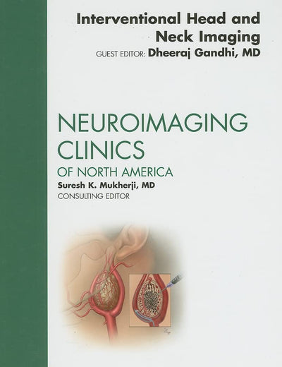 Interventional Head and Neck Imaging, An Issue of Neuroimaging Clinics (Volume 19-2) (The Clinics: Radiology, Volume 19-2)