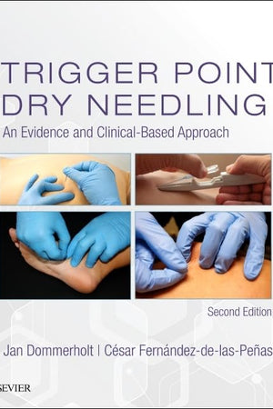 Trigger Point Dry Needling: An Evidence and Clinical-Based Approach