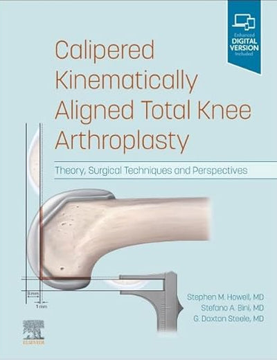 Calipered Kinematically aligned Total Knee Arthroplasty: Theory, Surgical Techniques and Perspectives