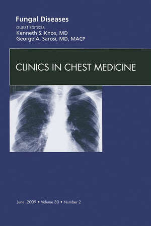 Fungal Disease, An Issue of Clinics in Chest Medicine (Volume 30-2) (The Clinics: Internal Medicine, Volume 30-2)