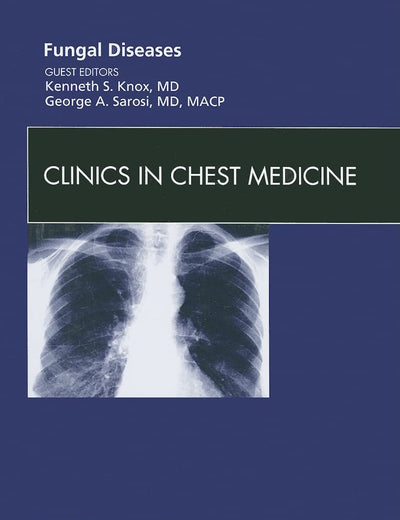 Fungal Disease, An Issue of Clinics in Chest Medicine (Volume 30-2) (The Clinics: Internal Medicine, Volume 30-2)