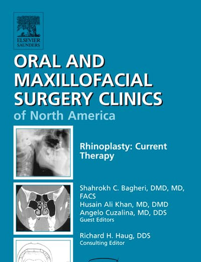 Rhinoplasty: Current Therapy, An Issue of Oral and Maxillofacial Surgery Clinics (Volume 24-1) (The Clinics: Dentistry, Volume 24-1)