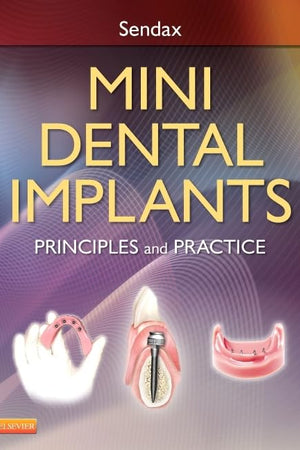 Mini Dental Implants: Principles and Practice