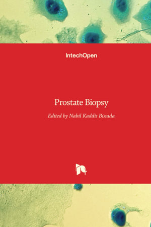 Prostate Biopsy