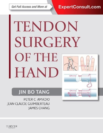 Tendon Surgery of the Hand: Expert Consult - Online and Print