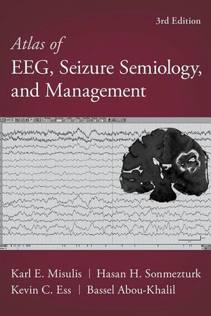 Atlas of EEG, Seizure Semiology, and Management
