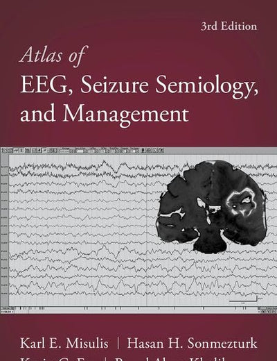 Atlas of EEG, Seizure Semiology, and Management