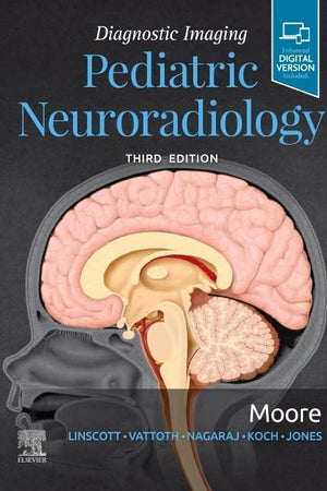 Diagnostic Imaging: Pediatric Neuroradiology