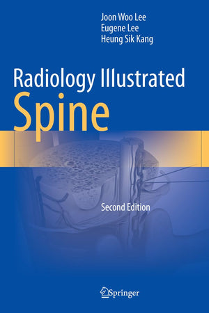 Radiology Illustrated: Spine