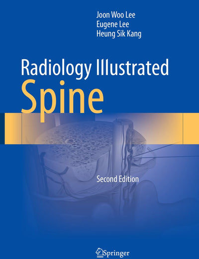 Radiology Illustrated: Spine