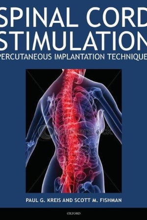 Spinal Cord Stimulation: Percutaneous Implantation Techniques