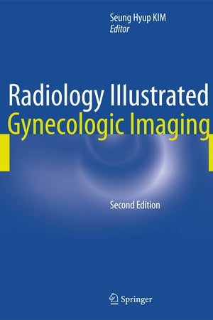 Radiology Illustrated: Gynecologic Imaging