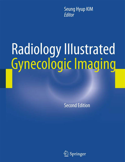 Radiology Illustrated: Gynecologic Imaging