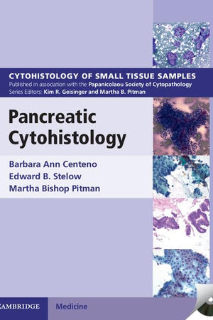 Pancreatic Cytohistology (Cytohistology of Small Tissue Samples)
