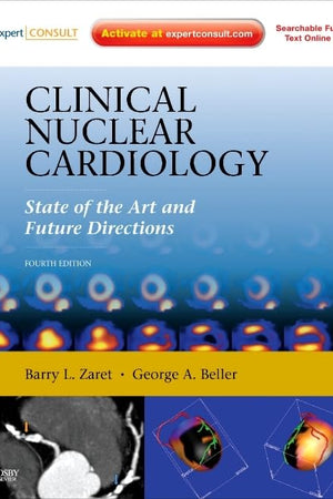Clinical Nuclear Cardiology: State of the Art and Future Directions