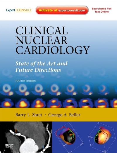 Clinical Nuclear Cardiology: State of the Art and Future Directions