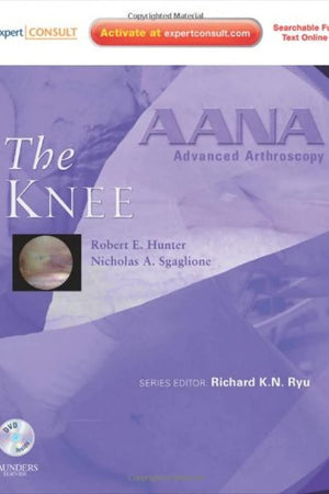 AANA Advanced Arthroscopy: The Knee: Expert Consult: Online, Print and DVD