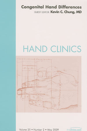 Hand Clinics, Vol. 25, No. 2: Congenital Hand Differences