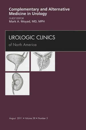 Complementary and Alternative Medicine in Urology, An Issue of Urologic Clinics (Volume 38-3) (The Clinics: Internal Medicine, Volume 38-3)
