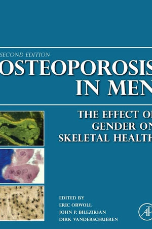 Osteoporosis in Men: The Effects of Gender on Skeletal Health