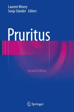 Pruritus