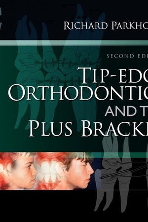 Tip-Edge Orthodontics and the Plus Bracket