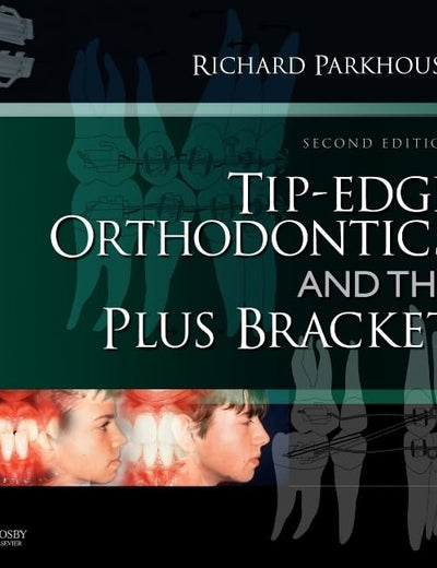 Tip-Edge Orthodontics and the Plus Bracket