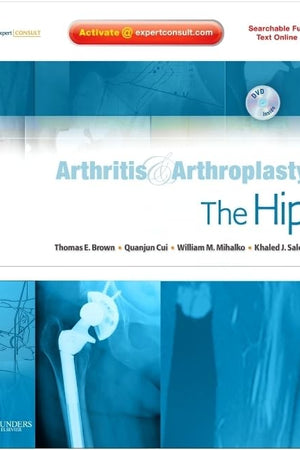 Arthritis and Arthroplasty: The Hip: Expert Consult - Online, Print and DVD