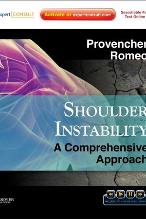 Shoulder Instability: A Comprehensive Approach: Expert Consult: Online, Print and DVD