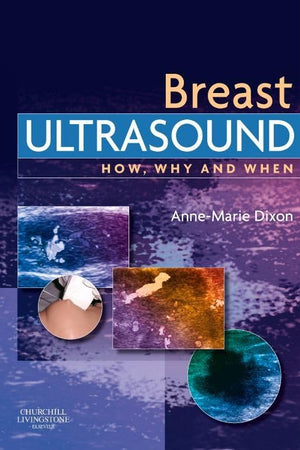 Breast Ultrasound: How, Why and When