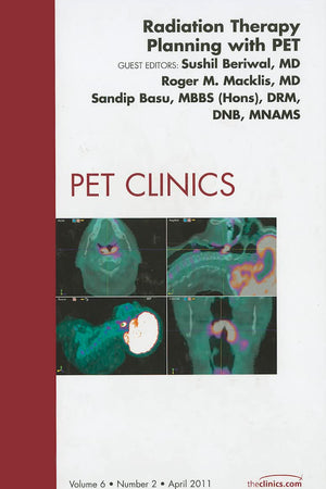 Radiation Therapy Planning with PET, An Issue of PET Clinics (Volume 6-2) (The Clinics: Radiology, Volume 6-2)