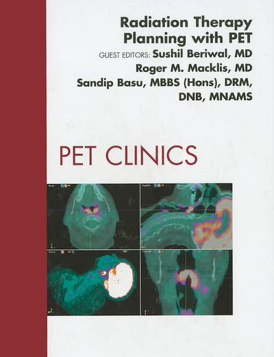 Radiation Therapy Planning with PET, An Issue of PET Clinics (Volume 6-2) (The Clinics: Radiology, Volume 6-2)