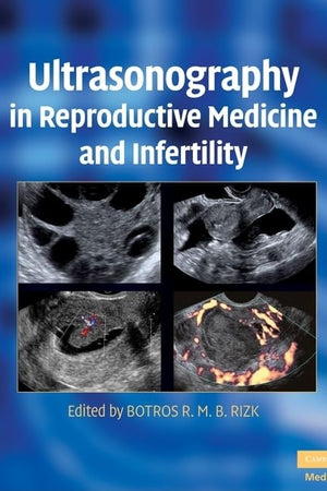 Ultrasonography in Reproductive Medicine and Infertility (Cambridge Medicine (Hardcover))