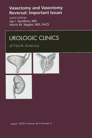 Vasectomy and Vasectomy Reversal: Important Issues, An Issue of Urologic Clinics (Volume 36-3) (The Clinics: Internal Medicine, Volume 36-3)