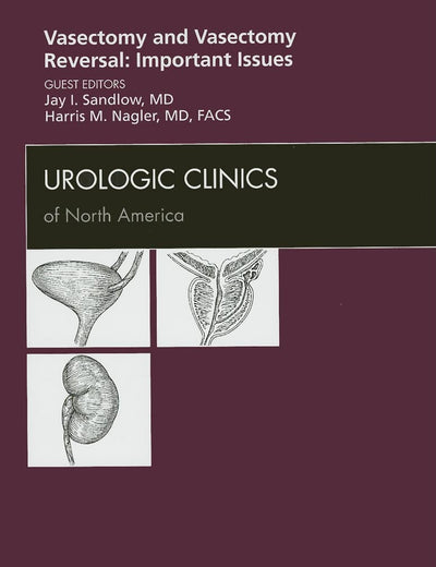 Vasectomy and Vasectomy Reversal: Important Issues, An Issue of Urologic Clinics (Volume 36-3) (The Clinics: Internal Medicine, Volume 36-3)