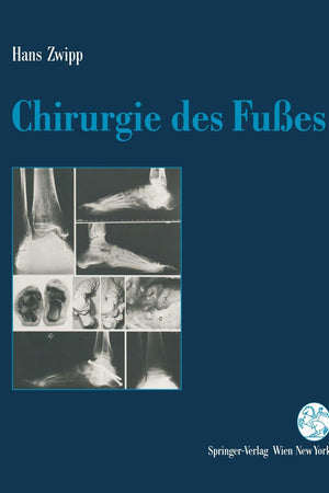 Chirurgie des Fußes (German Edition)