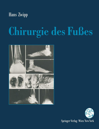 Chirurgie des Fußes (German Edition)