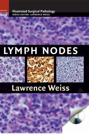 Lymph Nodes (Cambridge Illustrated Surgical Pathology)