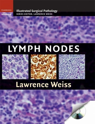 Lymph Nodes (Cambridge Illustrated Surgical Pathology)
