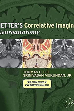 Netter’s Correlative Imaging: Neuroanatomy: with NetterReference.com Access (Netter Clinical Science)