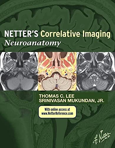 Netter’s Correlative Imaging: Neuroanatomy: with NetterReference.com Access (Netter Clinical Science)