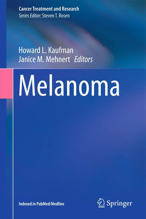 Melanoma (Cancer Treatment and Research, 167)