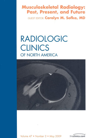 Musculoskeletal Radiology: Past, Present, and Future, An Issue of Radiologic Clinics (Volume 47-3) (The Clinics: Radiology, Volume 47-3)
