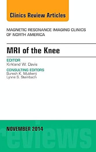 MRI of the Knee, An Issue of Magnetic Resonance Imaging Clinics of North America (Volume 22-4) (The Clinics: Radiology, Volume 22-4)