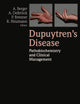 Dupuytren’s Disease: Pathobiochemistry and Clinical Management