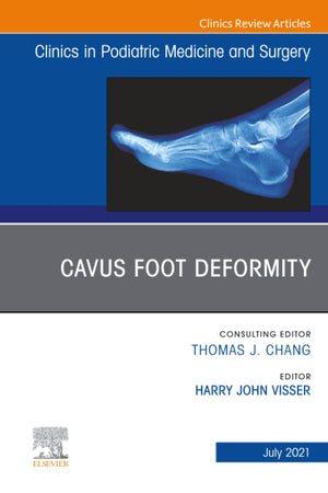 Cavus Foot Deformity, An Issue of Clinics in Podiatric Medicine and Surgery (The Clinics: Orthopedics, Volume 38-3)
