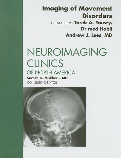 Imaging of Movement Disorders, An Issue of Neuroimaging Clinics (Volume 20-1) (The Clinics: Radiology, Volume 20-1)